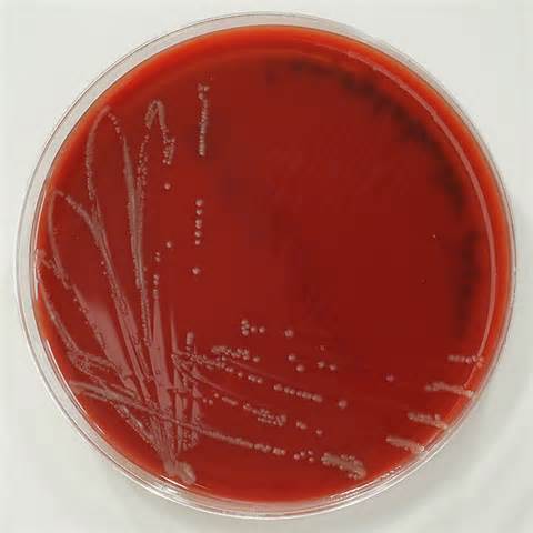 Media Types - Microbiology learning: The "why"ology of microbial testing
